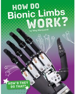 How Do Bionic Limbs Work?