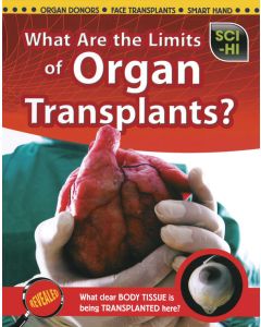 What Are the Limits of Organ Transplants?
